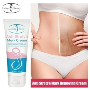 Anti Stretch Mark Cream 60gm